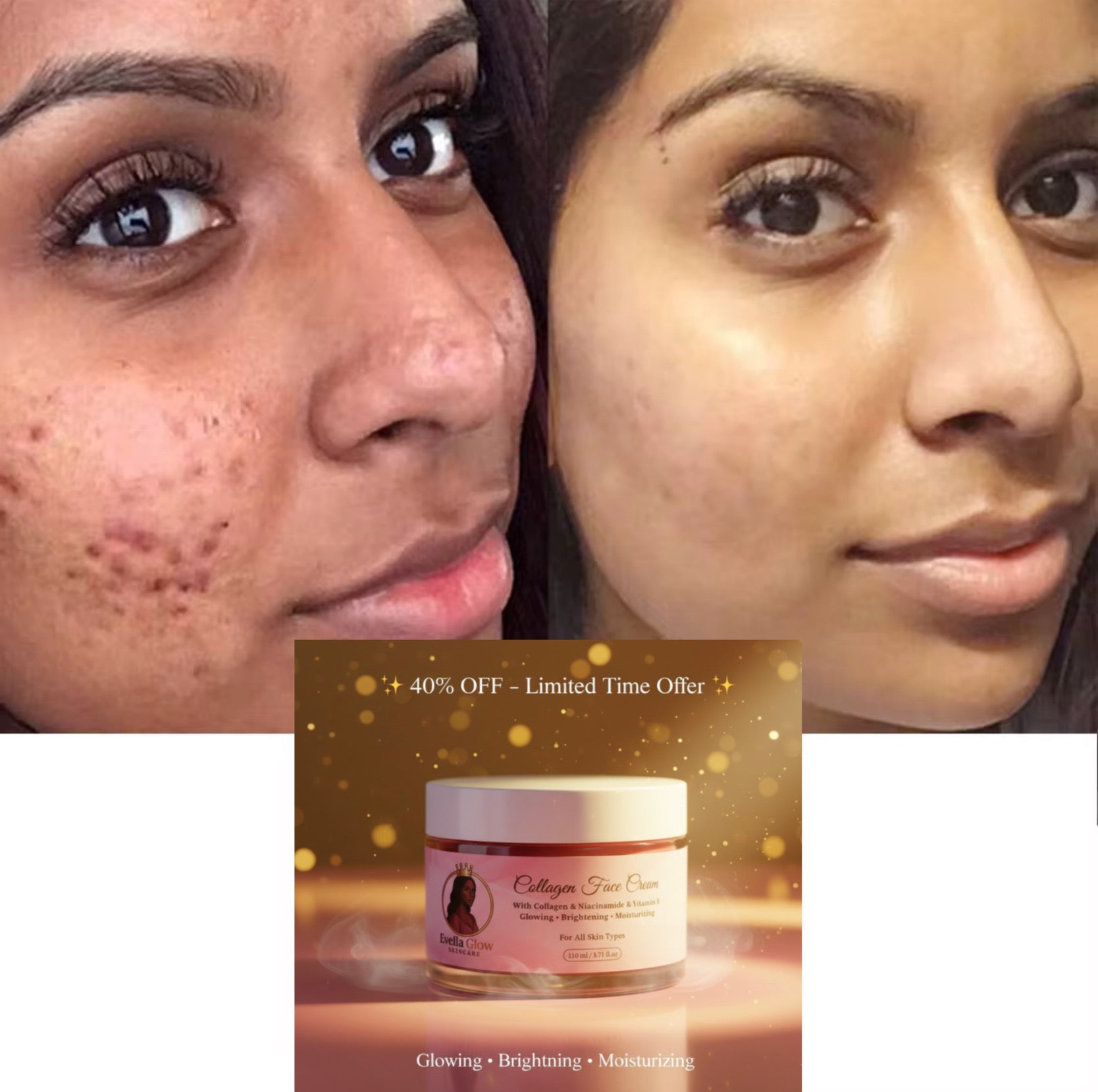 Evella Glow Collagen Face Cream – Glowing, Brightening & Moisturizing